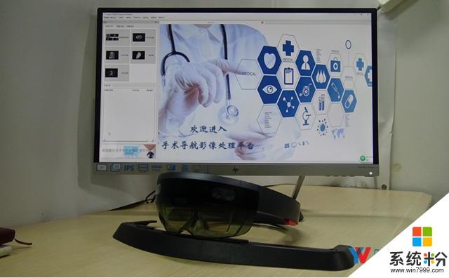 西安电子科大学生用HoloLens研发慢性心脏病医疗辅助平台(4)