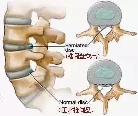 小米给你做“靠山”！小米149元腰靠黑科技，给你撑腰直背(5)