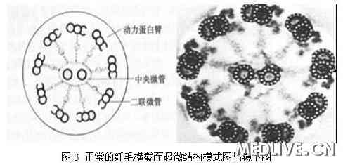 不动精子占30.2%是什么意思？