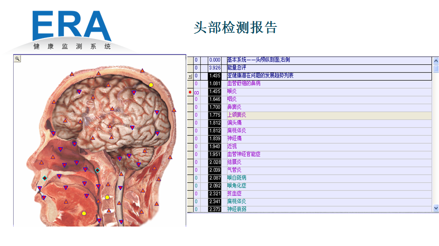 谁晓得全身断层扫描价格