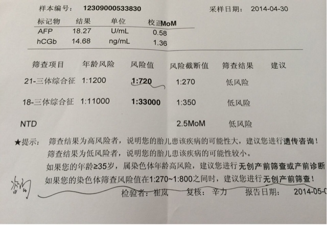 21三体综合征风险值1:950    基础风险值1:1339有问题吗