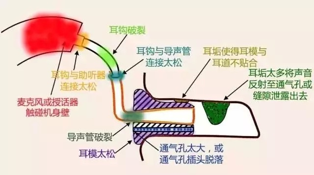 助听器有啸叫怎么处理