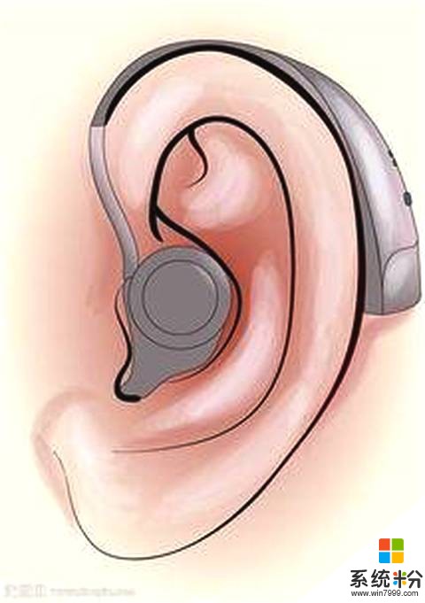带上助听器总觉得像别人用麦克风说话，时间久了会不会习惯？(图1)