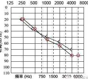 在人多吵的时候听不清，其他地方都没有问题，是怎么回事？(图1)