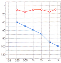 测听力，只有8kHZ有下降，其余频率都是正常，为什么？(图1)