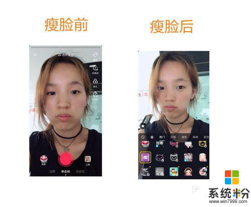 抖音里瘦脸功能怎么不见了